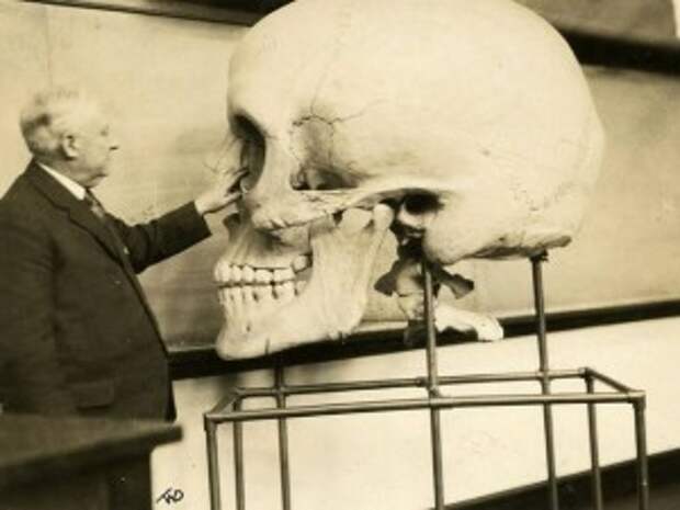 skeleton-5