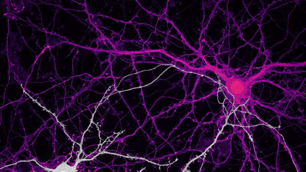 Science: активация сетей нейронов в дорсомедиальном гипоталамусе подавляет голод