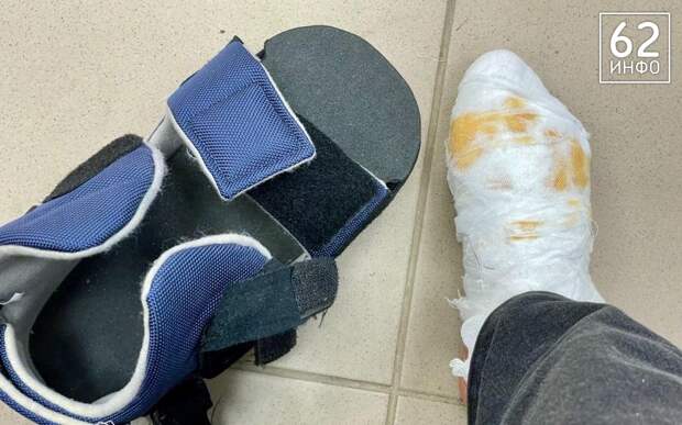 Рязанская девочка получила травму во время катания с горки