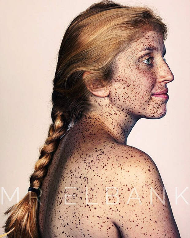 freckles-portrait-photography-brock-elbank-149__700