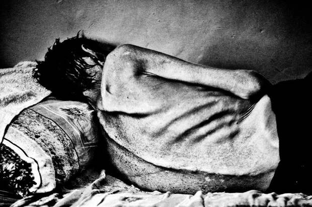 Туберкулез в постсоветское время