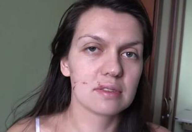 Врач элитной московской клиники избила беременную медсестру с Донбасса