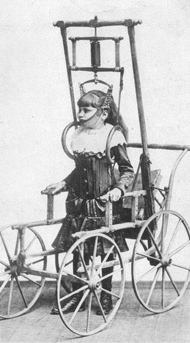 5.Спинной аппарат доктора Кларка рекламировался в 1878 году как аппарат, позволяющий людям с проблемами в спине ходить несколько минут – или даже часов – в день. медицина, ретро, фото