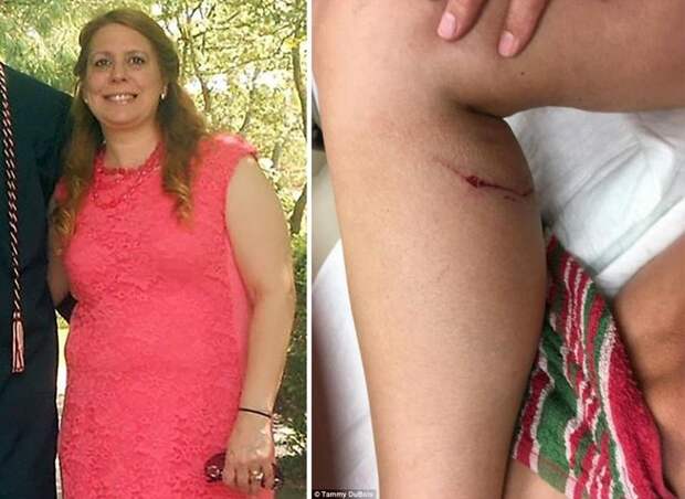 52-летняя американка задушила бешеную лисицу одной рукой 52-летняя американка задушила бешеную лисицу одной рукой бешенство, в мире, животные, лиса, люди, укус