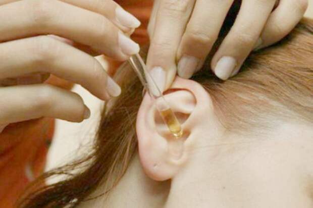 Серные пробки в ушах удалить совсем несложно. Этот рецепт самый безопасный