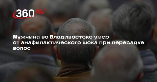 Мужчина во Владивостоке умер от анафилактического шока при пересадке волос