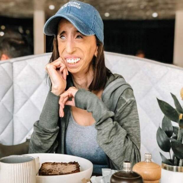 Lizzie Velasquez Pics