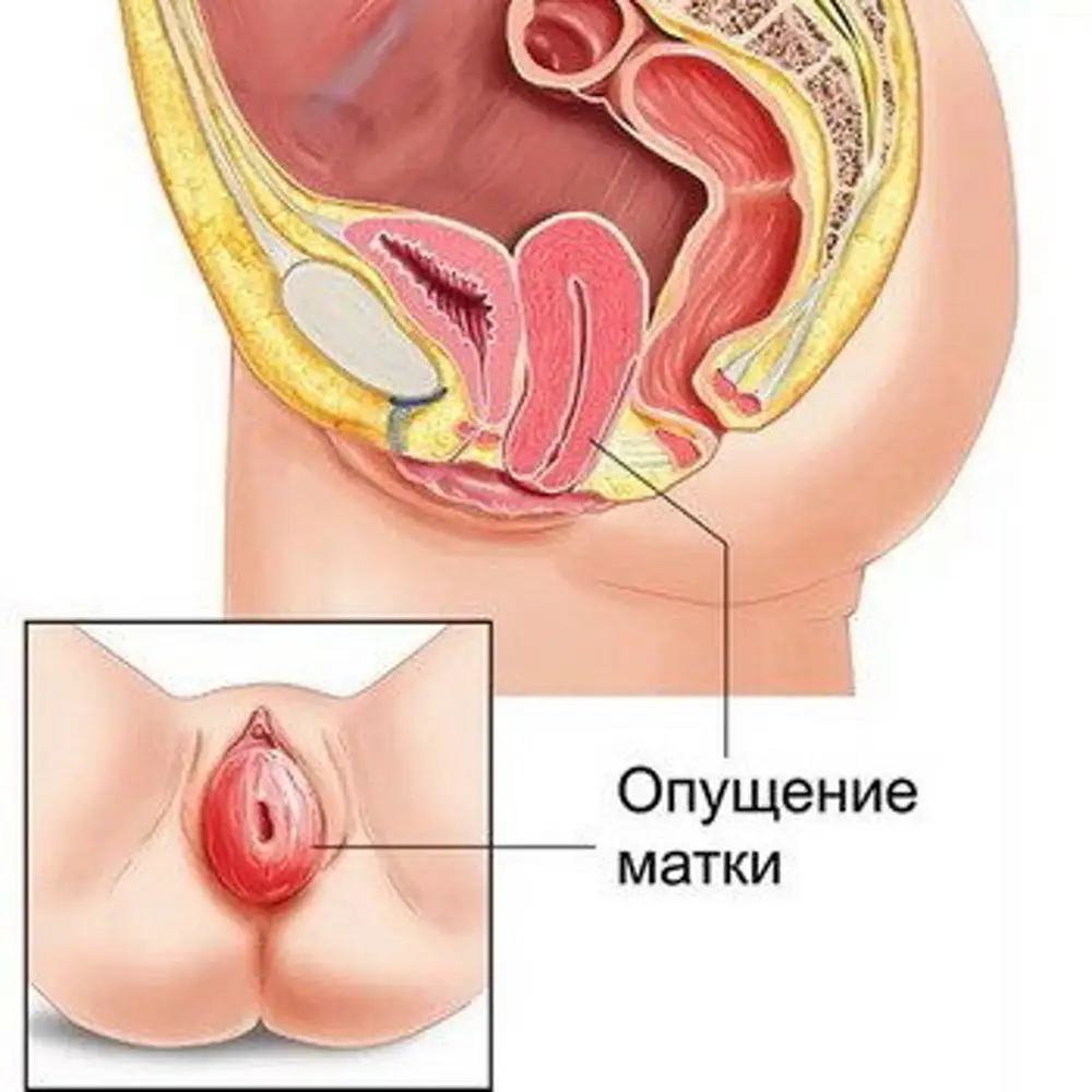 органы малого таза у женщин расположение фото