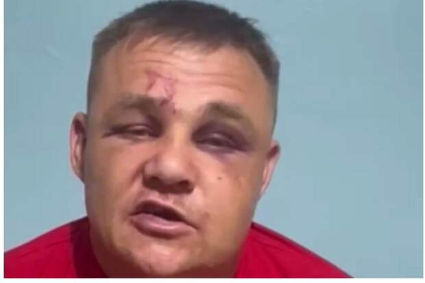 В Забайкальском крае участника специальной военной операции российских ВС на Украине избили после конфликта двух компаний в кафе.-6