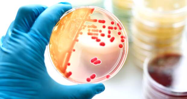 a blue gloved hand holding a plate with bacteria on it