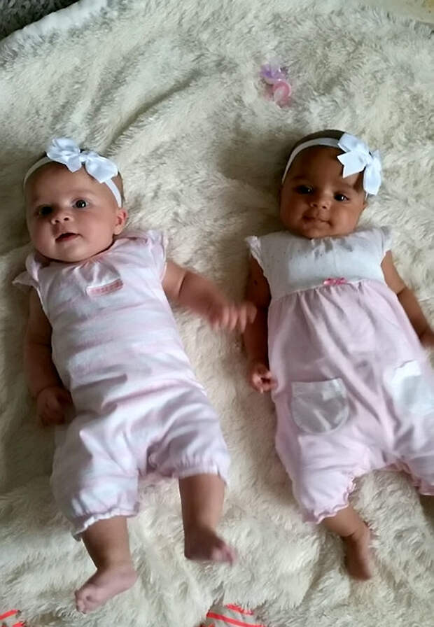 Никто не может поверить, что эти 10-месячные девочки — близняшки... Такое не каждый день увидишь!