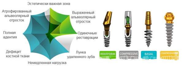 Имплант зубов