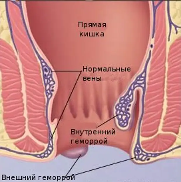 Геморроидальная вена