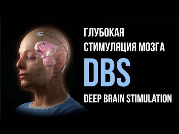 Видео дня: ликбез по DBS
