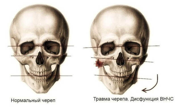 Лечение дисфункций височно-нижнечелюстного сустава