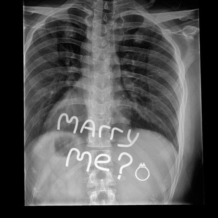 How To Propose To An X-Ray Tech