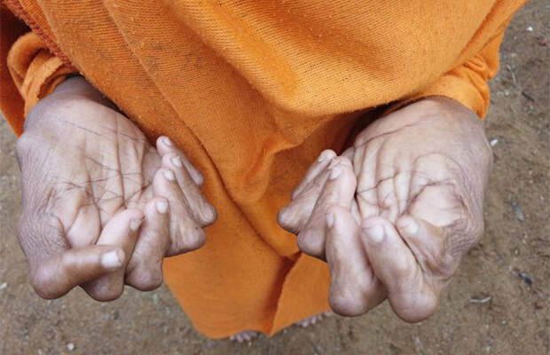 Женщина с 31 пальцем