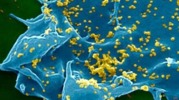 Первый случай смерти от вируса MERS был зарегистрирован в Саудовской Аравии в июне 2012 года