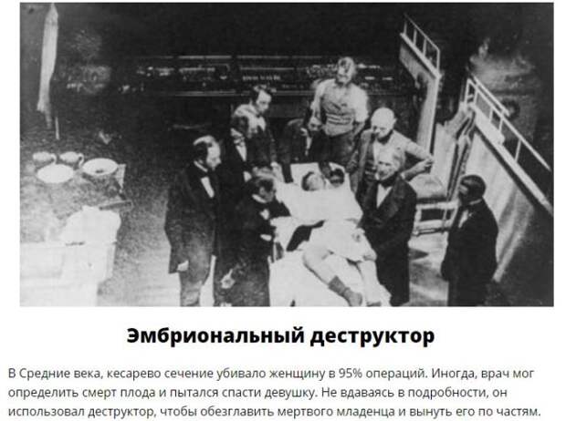 Жуткие медицинские инструменты прошлого (7 фото)