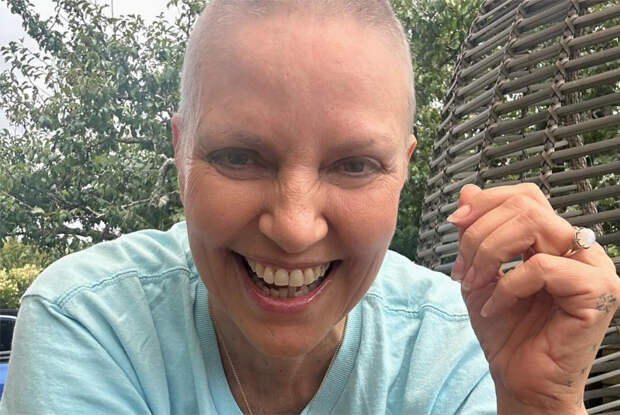 Болеющая раком ведущая рассказала о «суровом» лечении