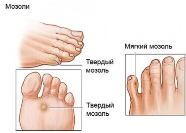 Народные методы лечения