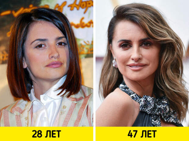 Как изменились знаменитости, которых раньше ценили за естественную красоту