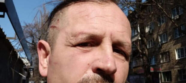 Экс-«узника Кремля» Владимира Балуха избили в Шевченковском ТЦК Киева