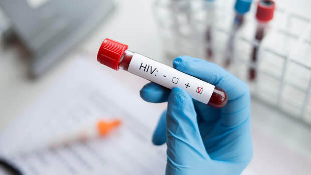 В Великобритании ВИЧ-инфицированным разрешат быть донорами спермы и яйцеклеток