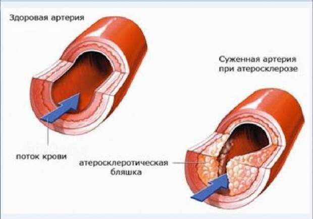 Крупнейшая афера ХХ века