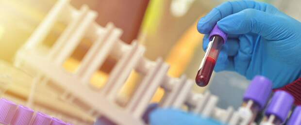 Анализ крови повышает точность диагностики болезни Альцгеймера на ранней стадии до 95%