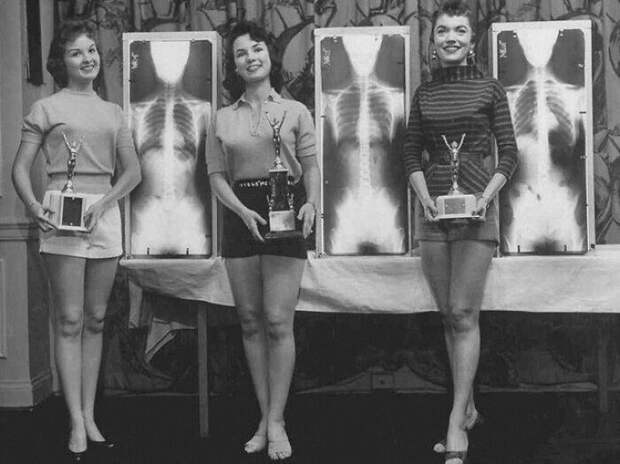 Конкурс "Мисс идеальная осанка" в Чикаго, 1956 год. По условиям конкурса, участницы предъявляли свои рентгеновские снимки Конкурс "Мисс идеальная осанка" в Чикаго, 1956 год. По условиям конкурса, участницы предъявляли свои рентгеновские снимки