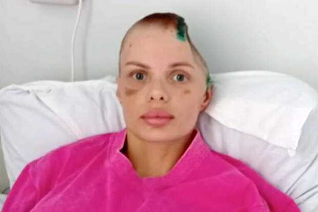 "КП": модель Тартанова отказалась простить избившего ее экс-возлюбленного