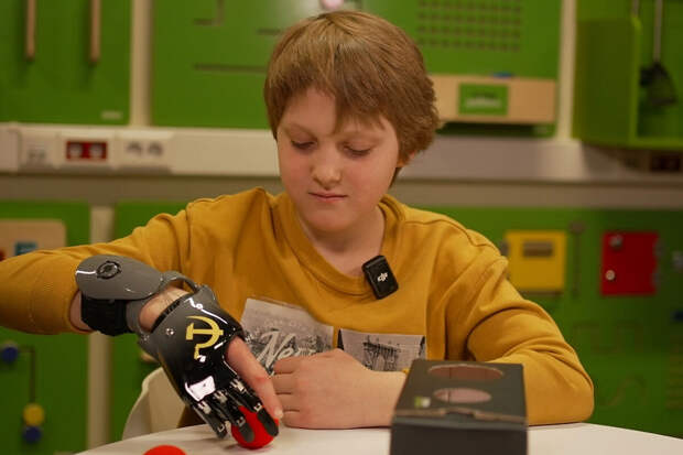 MSK1.ru: мальчик, которому оторвало пальцы в Красногорске, получил протез