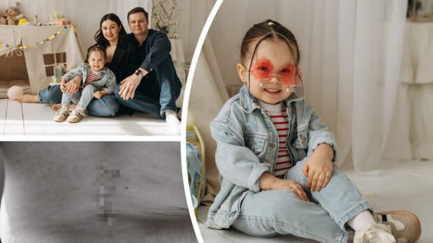 "Ребенок будет инвалидом". Новосибирские хирурги спасли девочку с грыжей позвоночника