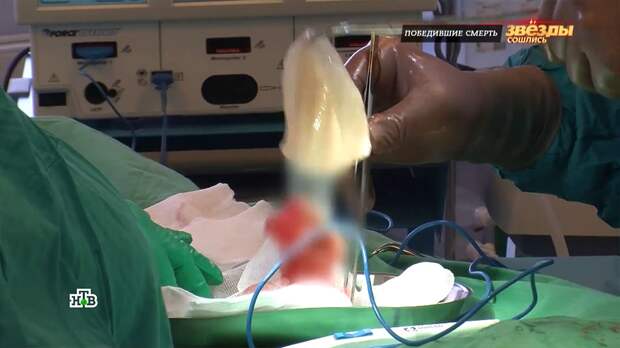 После разрыва силиконового импланта грудь известной писательницы собрали по кусочкам