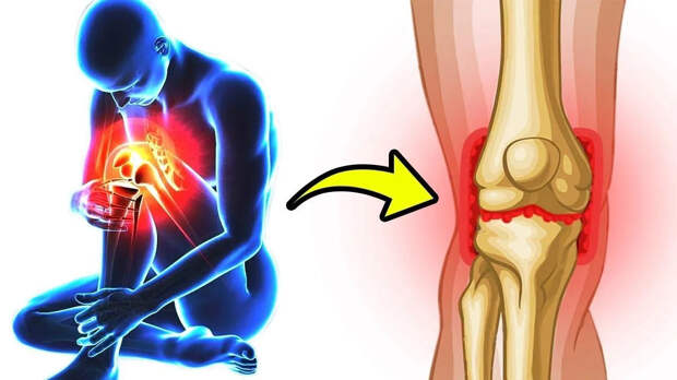 Ноют суставы ног: причины, диагностика и лечение боли | Полный обзор