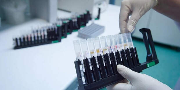 Мазус: В Москве применяется самый точный метод диагностики на антитела к коронавирусу. Фото: mos.ru