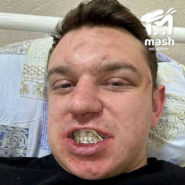 В Симферополе праздничный банкет закончился реанимацией для официанта