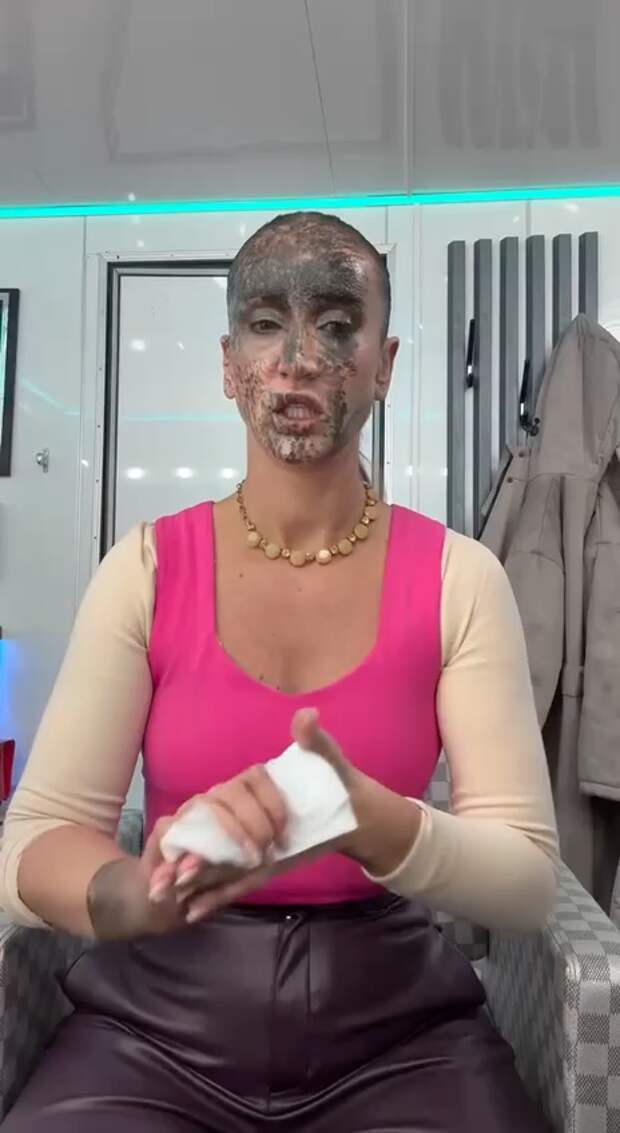 Ольга Бузова показала издержки актёрской профессии: «Это треш»