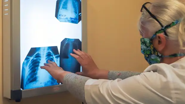 Переболевшим COVID-19 в тяжёлой форме разрешили не вакцинироваться