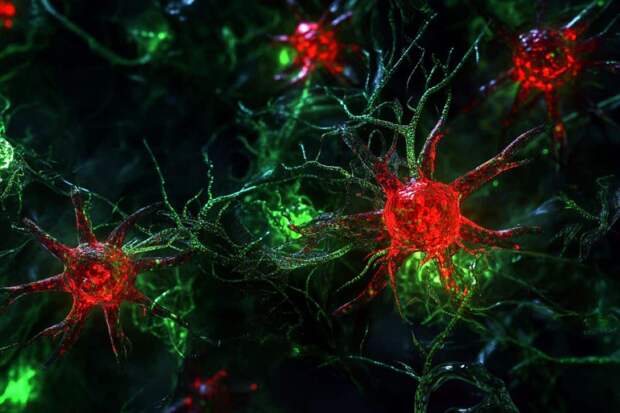 Новое исследование: Астроциты как перспективная терапия для лечения нейродегенеративных заболеваний