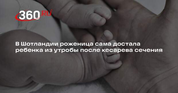 В Шотландии роженица сама достала ребенка из утробы после кесарева сечения