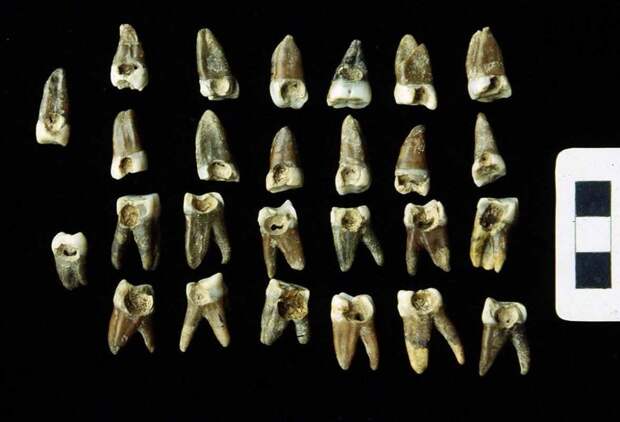 Зубы, заполненные полостью, найдены на древнем римском форуме, I век нашей эры, через Forbes