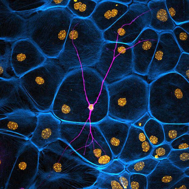 Нейрон и стволовые клетки