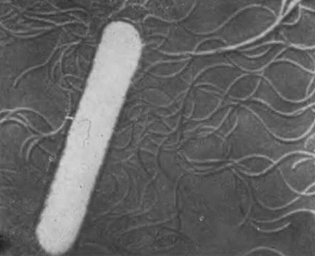 Микрофотография Clostridium tetani — хорошо видны жгутики.