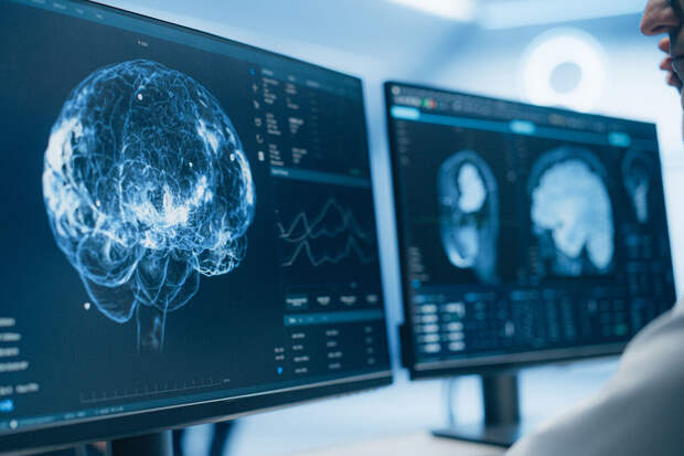 iScience: обнаружен механизм, который помогает мозгу избавляться от отходов