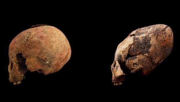 Черепа двух детей восьми лет. Справа — деформированный / ©Zhang et al., American Journal of Physical Anthropology, 2019