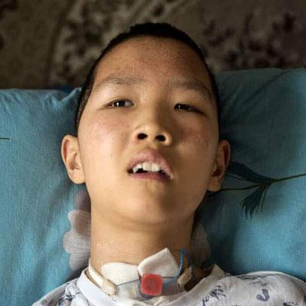 Эрдэни Аюшеев, 12 лет, последствия тяжелой закрытой черепно-мозговой травмы, требуется реабилитация, 449 677 ₽