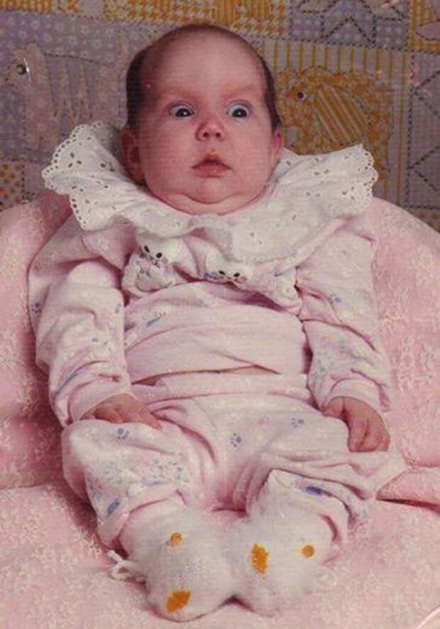 WorstBabyPhotos15 Эти ужасные младенцы