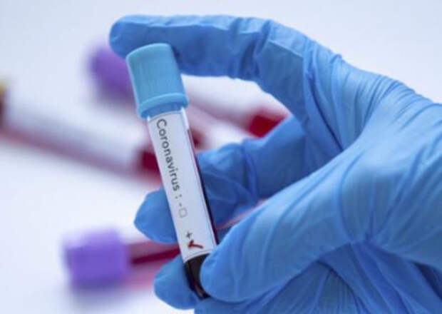 Губернатор Херсонщины выписал почти миллион гривен на премии сотрудникам ОДА, лишив доплат медиков